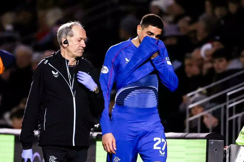 Rangers Manager Geeft Blessure-update over Balogun voorafgaand aan Celtic-wedstrijd